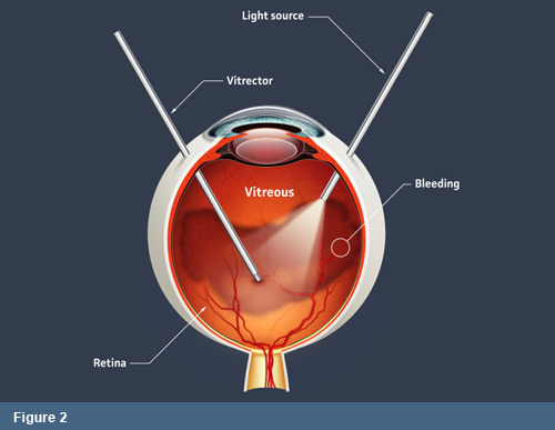 Figure 2 - Eye Anatomy